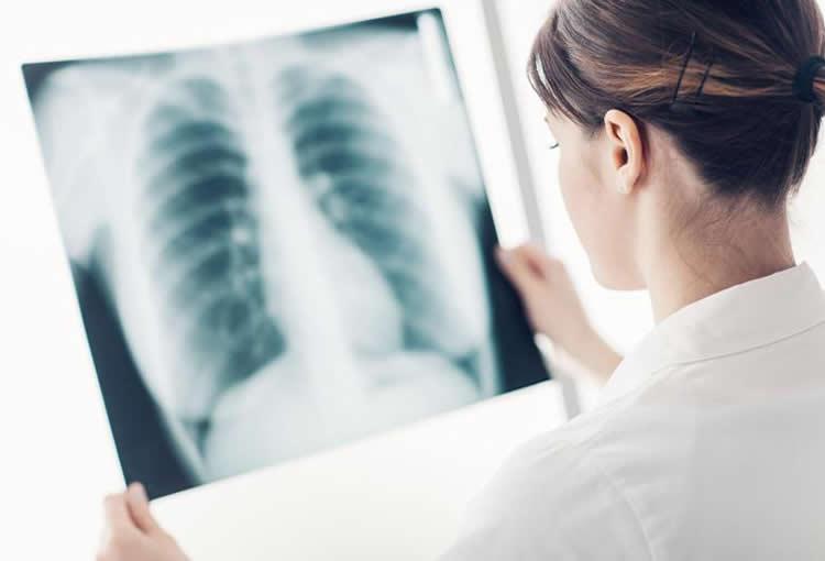 Exames de imagem que ajudam a diagnosticar doenças pulmonares