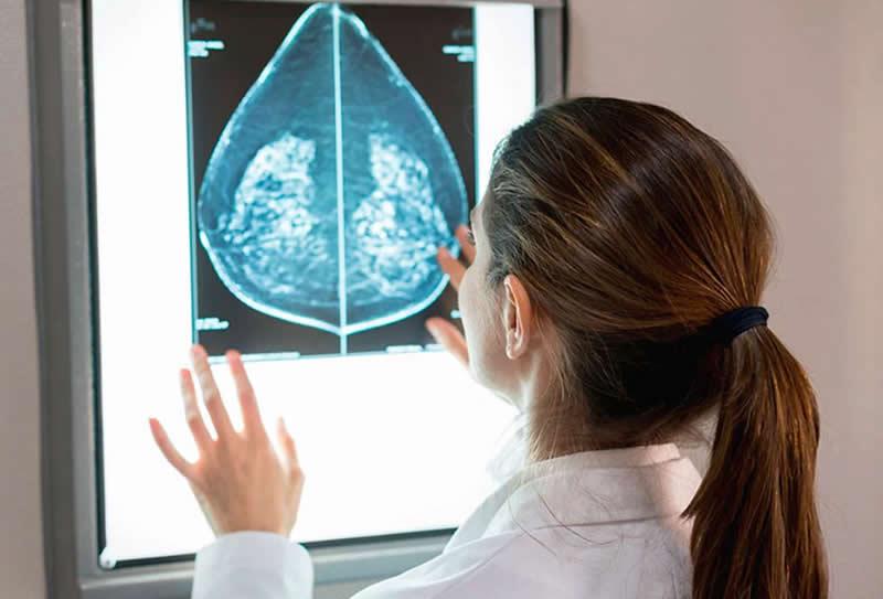 Principais mitos em relação à mamografia