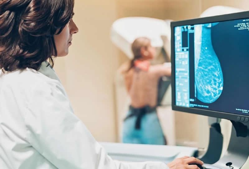 Como é feito o exame de mamografia?