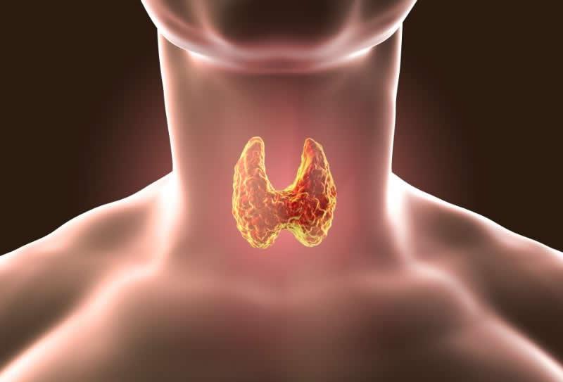 Câncer na Tireóide, saiba o que é e quais sintomas