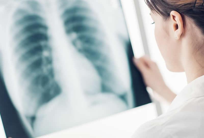 Exames de Imagem que ajudam a diagnosticar Distúrbios Pulmonares