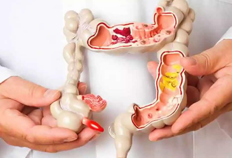 Exames de imagem para diagnóstico do Câncer Colorretal