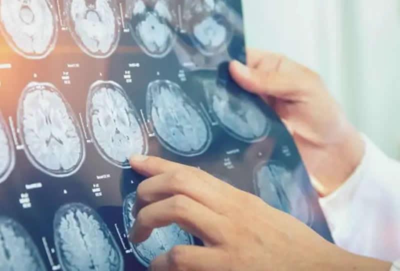 Câncer: Importância dos exames de imagem no diagnóstico